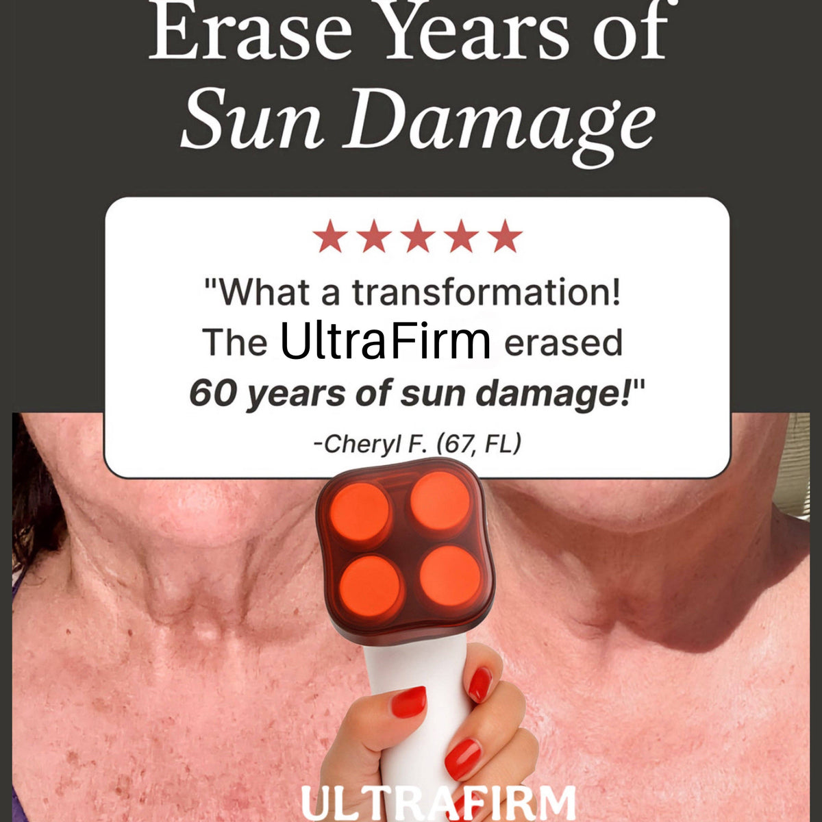 UltraFirm™ Fat Iron | Crepey Skin Eraser