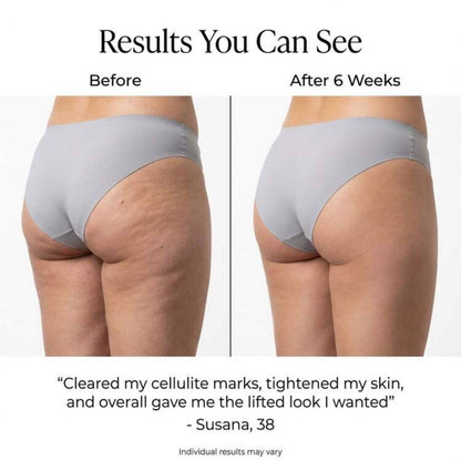 UltraFirm™ Fat Iron | Crepey Skin Eraser